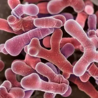 Bifidobacterium longum BB536